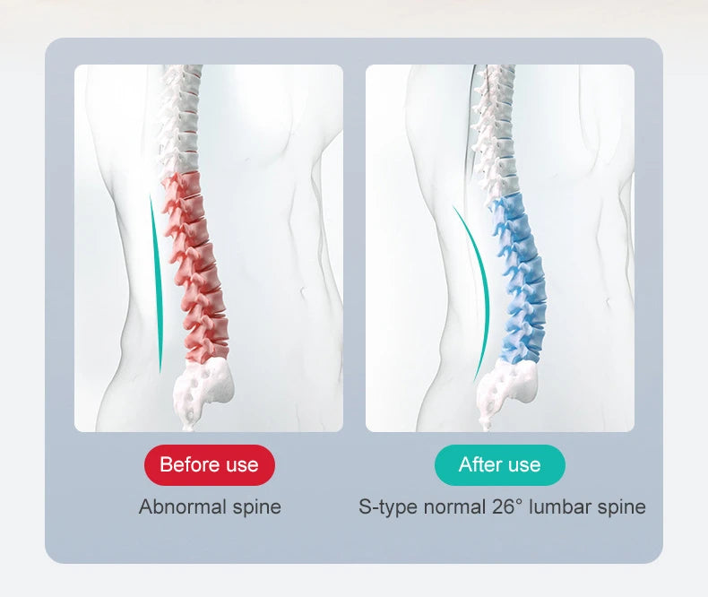 Back Stretcher Multi-Level Adjustable Massager Waist Neck Fitness Lumbar Cervical Spine Cervical Spine Support Massager Lying